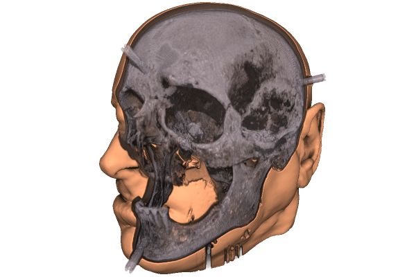 Visibility Optimization for Direct and Indirect Volume Rendering using Level Set Propagation